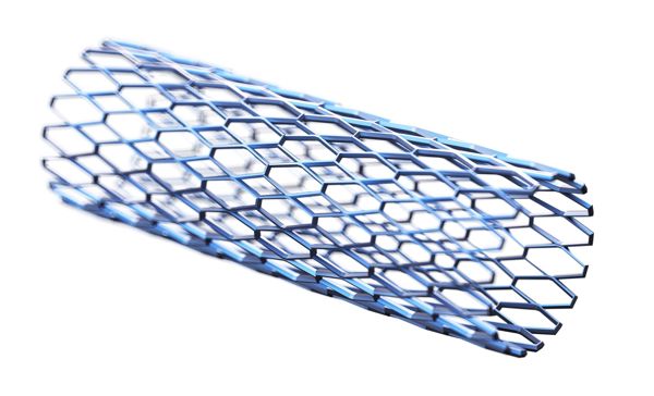 Illustration of a stent